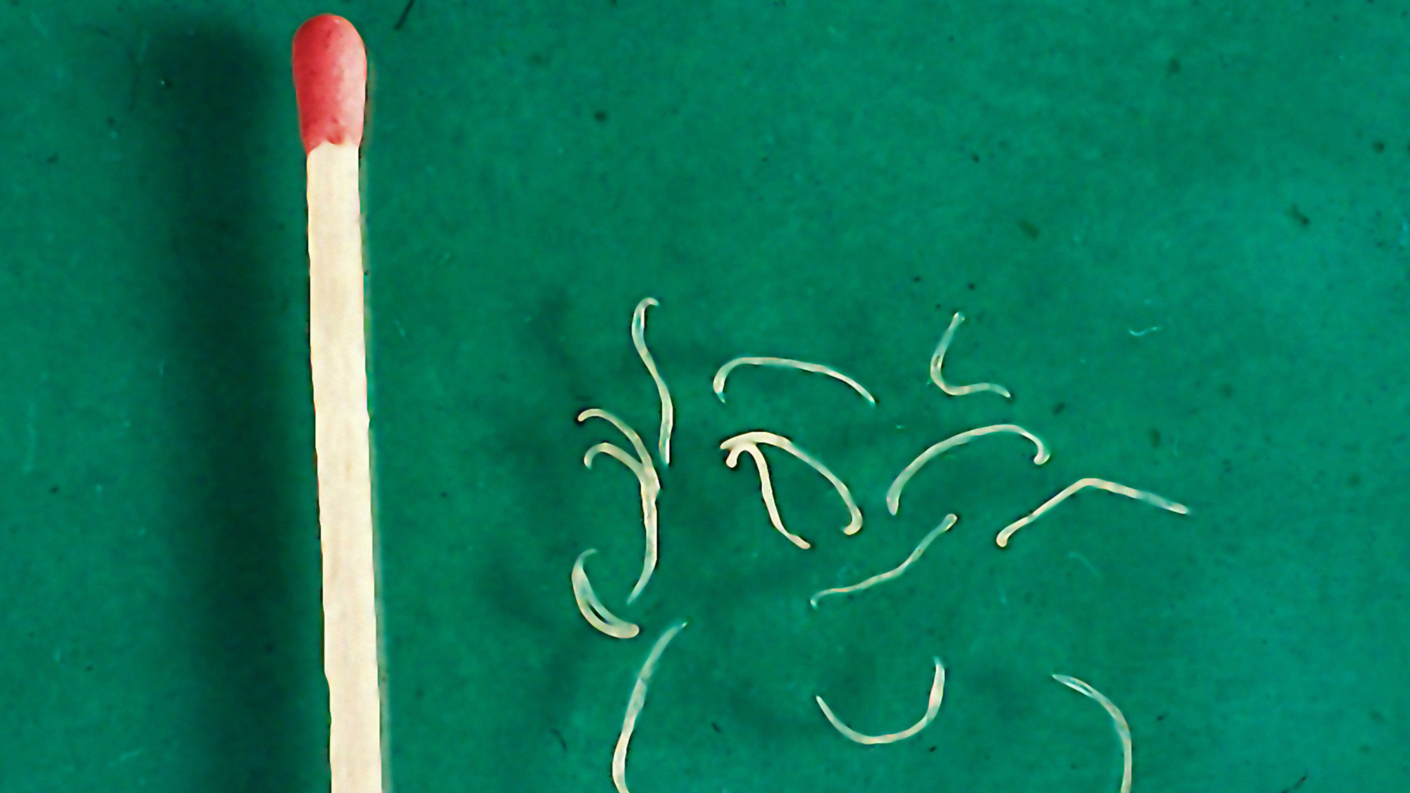 Why It Can Be Harder To Fight Hookworms In Alabama Than In Argentina | KPBS  Public Media, image size:2000x1125