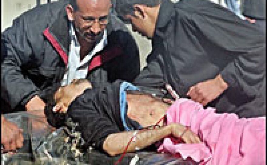 A badly wounded Iraqi man arrives at al-Yarmouk hospital after he was injured in one of two attacks which targeted Shiite mosques in Baghdad, Feb. 18.