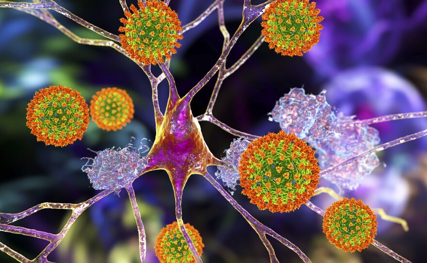Researchers are learning that  the coronavirus can infect neurons and may cause lasting damage in some cases.