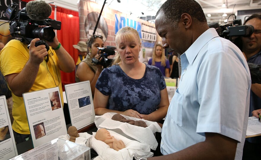 Carson looks at a display of fetus models at the "Iowa Right to Life" booth at the Iowa State Fair.