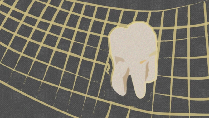 Most California dentists refuse to participate in the “Denti-Cal” program, leaving patients with impossible wait times that lead to lost teeth, horror stories and expensive health consequences.