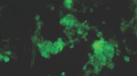 Stem cell-derived cardiomyocytes (heart muscle cells) expressing a green fluorescent protein.