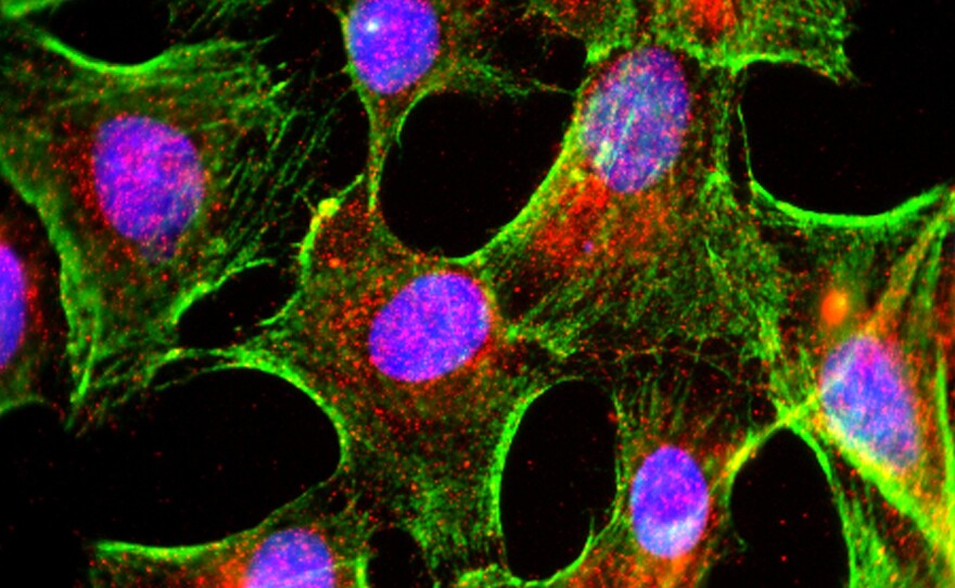 Fluorescent deconvolution micrograph of cultured glial cells expressing tau protein (in red). Glial cells are nervous system cells that provide structural support and protection for neurons (nerve cells). Accumulation of tau in brain tissue is linked with a number of neurodegenerative diseases, including Parkinson's disease and Alzheimer's disease.