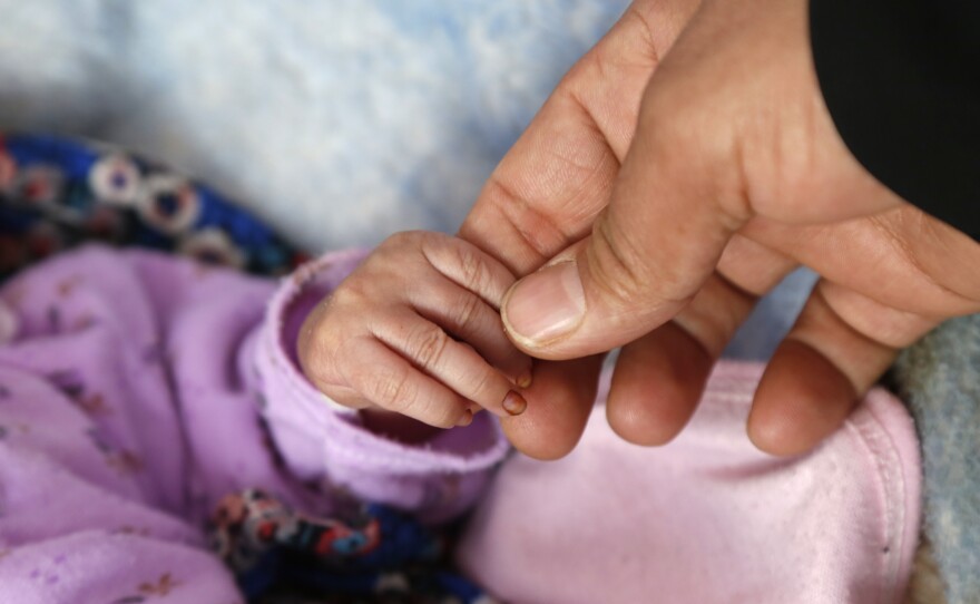 A nurse checks a child who is receiving treatment for malnutrition at a hospital in Sana'a, Yemen. The photo was taken on December 13.
