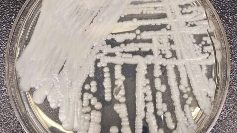 This is a strain of Candida auris cultured in a petri dish at a laboratory at the Centers for Disease Control and Prevention. It's a form of yeast that can harm humans — and is resistant to the most common antifungal drugs.