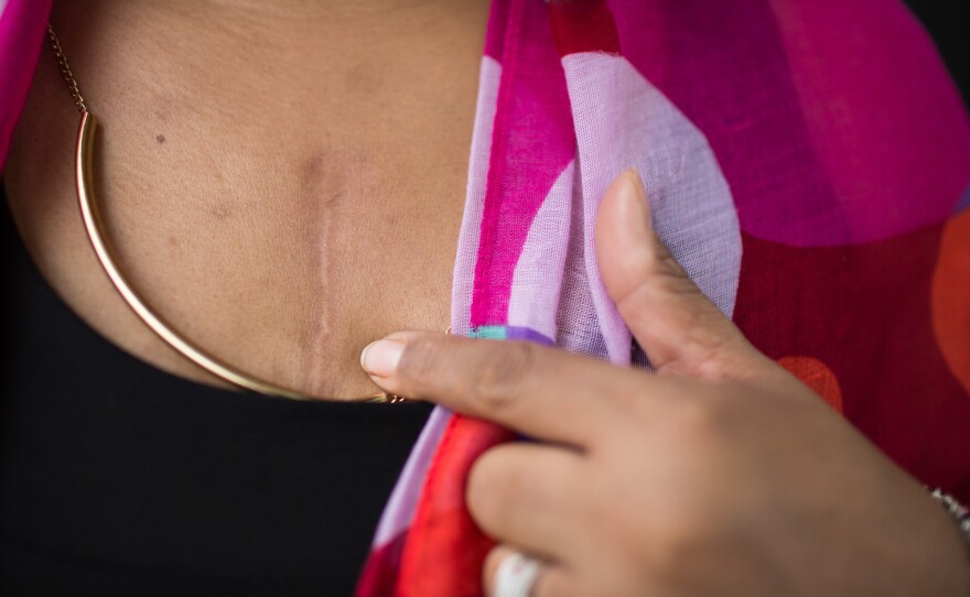 Last year Solomon Clark had double-bypass surgery to replace the left main artery of her heart.