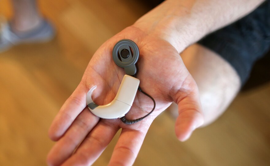 When his cochlear implant was first switched on, the world sounded different.