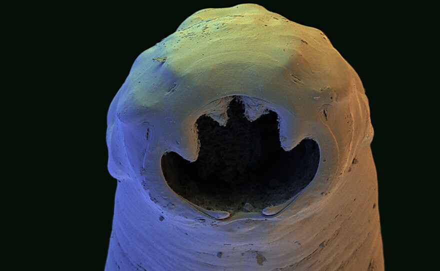 The Old World hookworm is an intestinal parasite. The image above was taken by a scanning electron micrograph and was color-enhanced. The worm's actual size ranges from 0.03 inches to 0.3 inches.