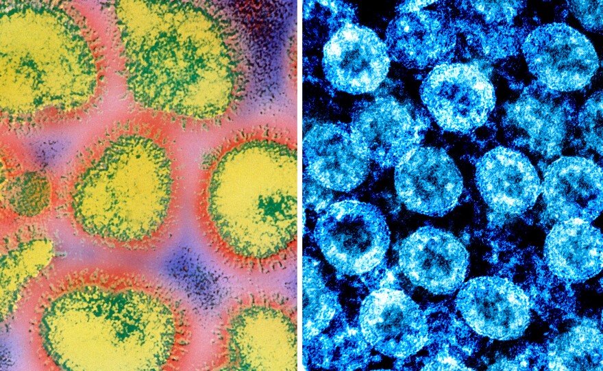 At left: a colorized electron micrograph image of the influenza virus. At right: color-enhanced electron micrograph image of SARS-CoV-2 virus particles, isolated from a patient.