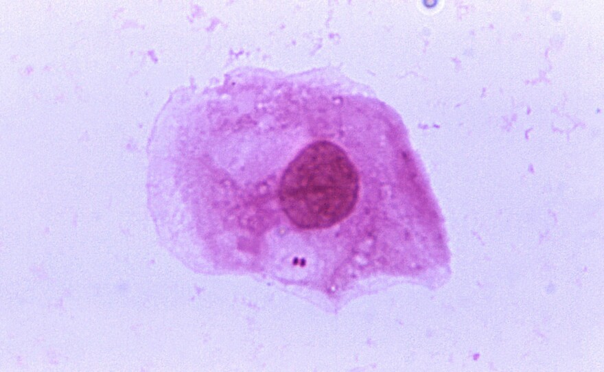 This bacteria is the cause of the mystery illness in Liberia. We don't want to give it away ... so you'll have to read the story to find out what it is.