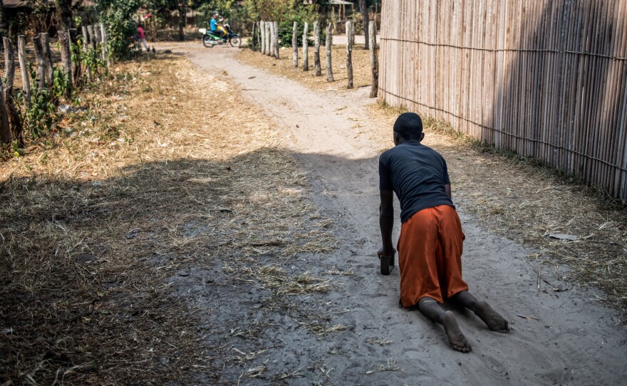 Fils Kunduku, 9, has paralysis in both legs. In Kahemba, many people with konzo crawl through the street because they cannot afford wheelchairs.