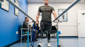 Oleksandr Fedun, 24, holds onto railings as he practices walking on his prosthetics at Medical Center Orthotics & Prosthetics (MCOP) in Silver Spring, Md., on February 2, 2023. MCOP is working with several charities and organizations to help fit Ukrainian soldiers with prosthetics after they've been injured in combat.