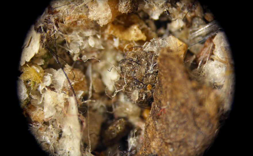 This Storage Mite is smaller than a grain of sand.