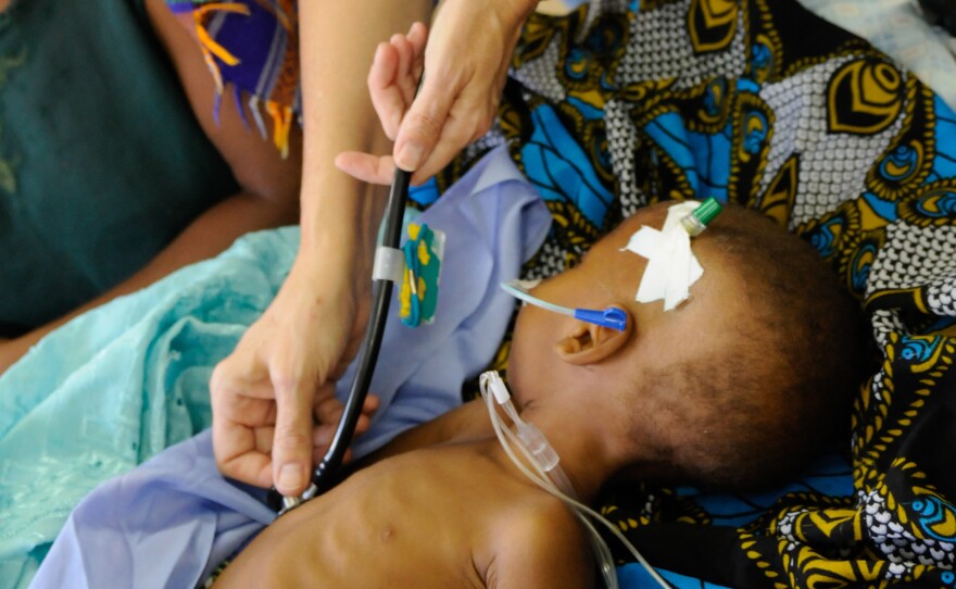 Dr. Terry Taylor treats a child with severe malaria at the Queen Elizabeth Central Hospital in Blantyre, Malawi.