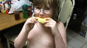 Alex Williamson, 8, is one of 17 million children who live in U.S. households where getting enough food is a challenge. Sometimes it's hard for the poor to eat healthy because it costs more.