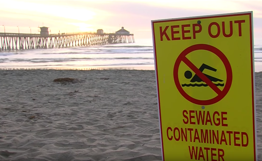 A beach closure sign is posted at Imperial Beach due to water pollution, Feb. 13, 2017.