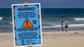 A sign warning people to stay out of the water is shown at Imperial Beach on July 18, 2023.