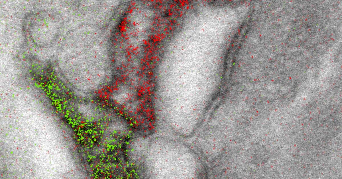 San Diego Scientists Add Color To Black And White Electron Microscopes San Diego Scientists Add Color To Black And White Electron Microscopes