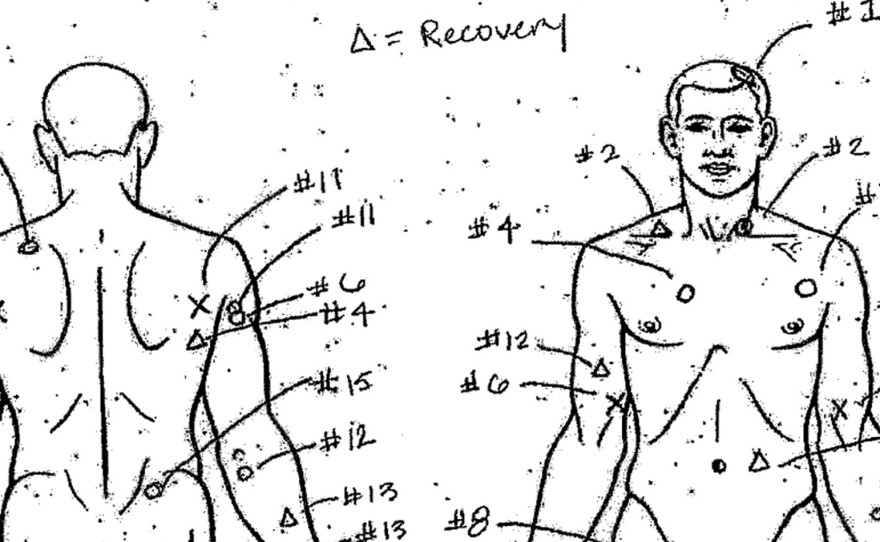 An autopsy diagram provided by the Cook County Medical Examiner's office shows the location of wounds on the body of Laquan McDonald.