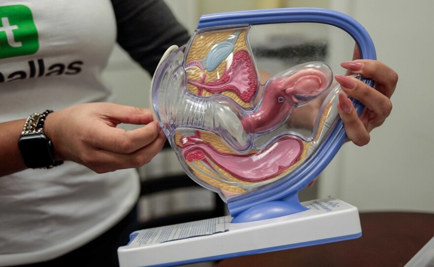 An educator in Dallas holds an instructional device at the North Texas Alliance to Reduce Unintended Pregnancy in Teens. The group offers sex education to young people to equip them to be adults.