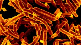 A scanning electron micrograph of Mycobacterium tuberculosis bacteria, which cause TB.