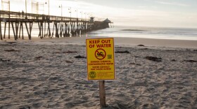 A warning sign about sewage and chemical contamination is posted along the shore of Imperial Beach on Nov. 21, 2025.
