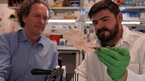 Allen Institute scientist Aaron Garcia (right) and executive vice president Ed Lein (left) examine a section of human brain in the lab. The institute has launched the Brain Health accelerator, which will focus on using genetic therapy to develop treatments for a range of brain disorders.