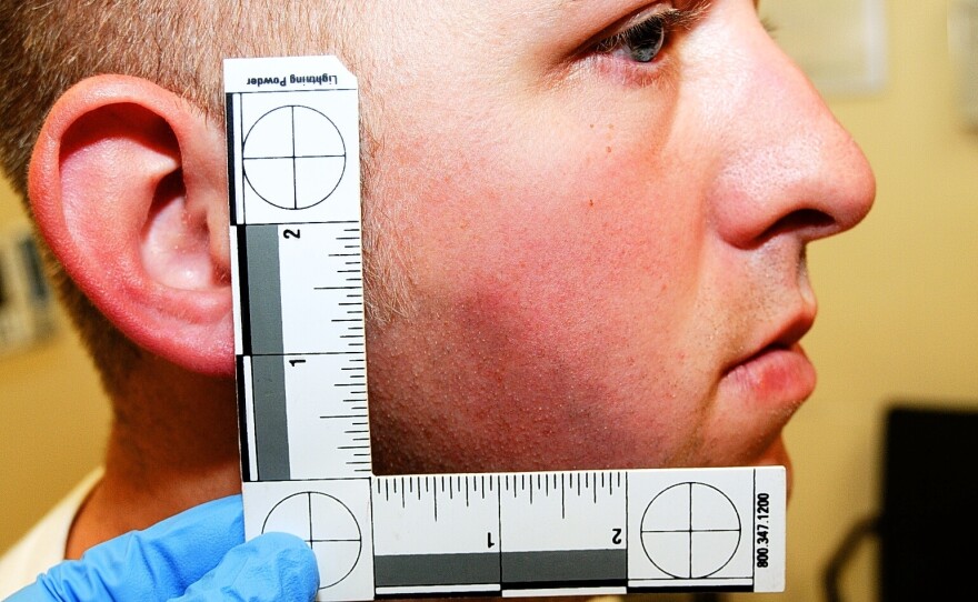 Ferguson police officer Darren Wilson during his medical examination.