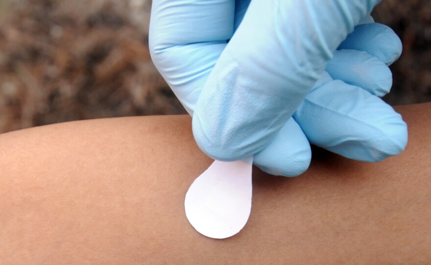 A patch that's the size of a nickel could one day administer the measles vaccine.