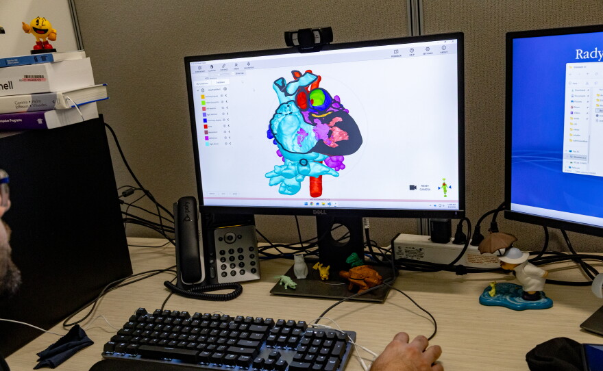 Parham Gholami, research engineer, demonstrates the lab's computational model technology with a patient's heart at Rady Children’s Hospital, Webster Foundation 3D Innovation Lab on August 6, 2026.