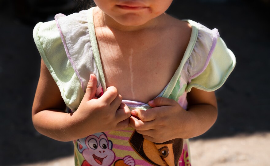 Tania and Joseph's 3-year-old daughter has a scar on her chest from heart surgery. The family has lived in shelters for months while waiting for their time in court.