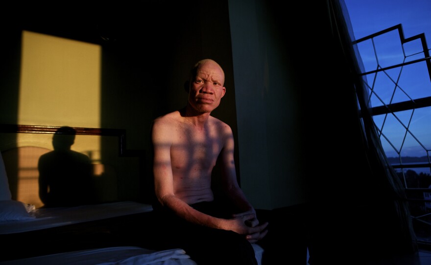 "In the Shadow of the Sun" explores the violent prejudice -- mostly based on superstition -- experienced by albinos in Tanzania.