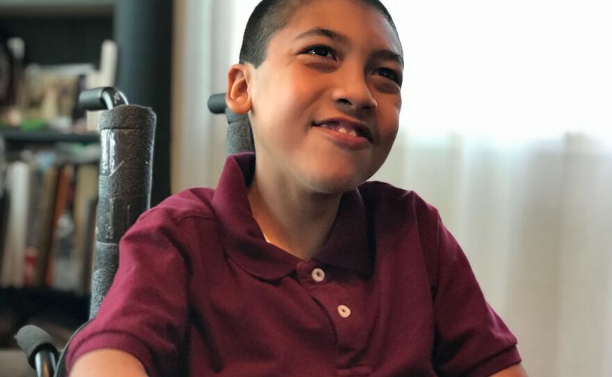 San Diego Child Only Known Person In World With This Rare Form Of