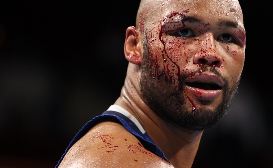 Britain's Frazer Clarke bleeds after an injury as he fights Uzbekistan's Bakhodir Jalolov during their men's super heavy (over 91kg) semi-final boxing match on August 4.