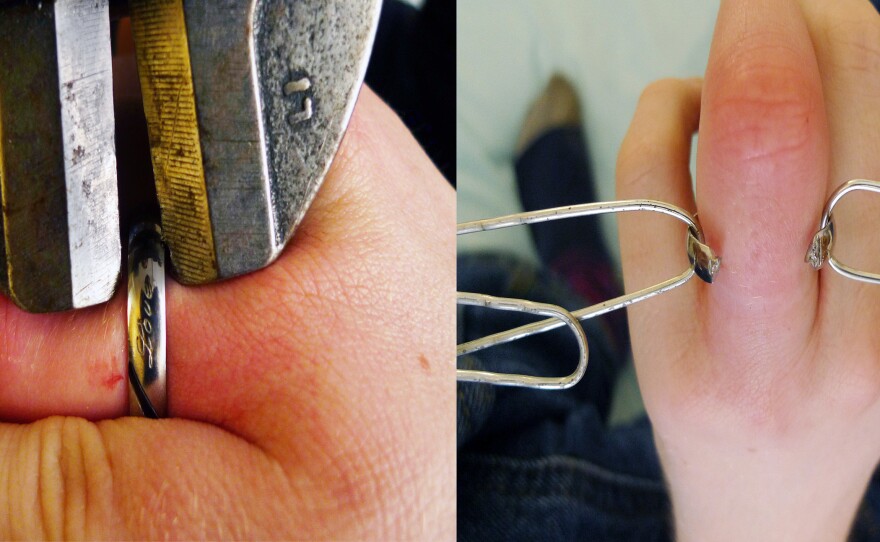 The titanium ring, before and after being removed by bolt cutters.