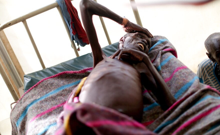 An elderly man waits to see a doctor at the Doctors Without Borders hospital. South Sudan is facing a major food shortage, and many patients are malnourished.