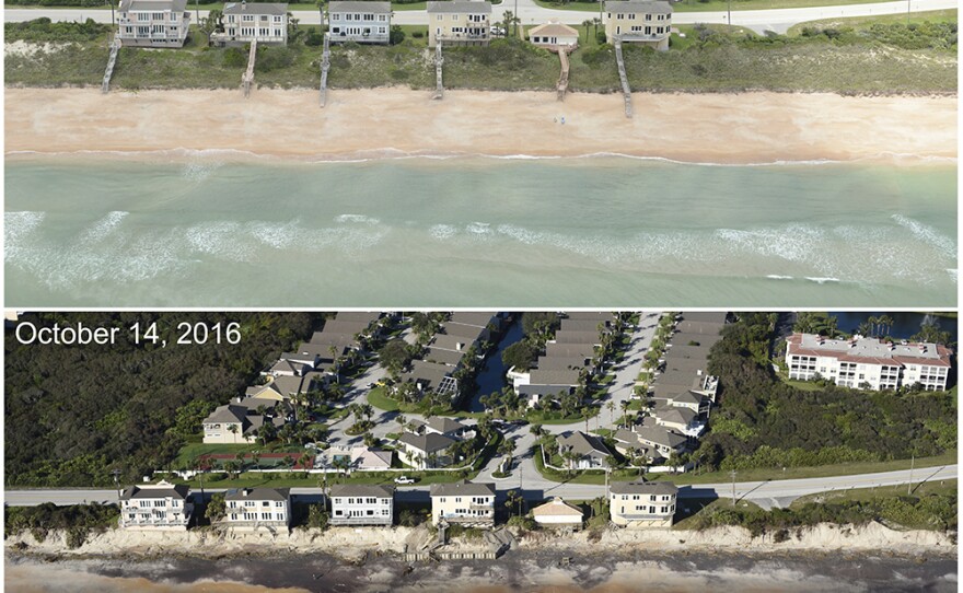 Photos taken before Hurricane Matthew (Sept. 6, 2014) and after (Oct. 14, 2016) show that the storm washed away a 16-foot sand dune, destroying boardwalks and decks and exposing an old seawall at Vilano Beach, Fla.