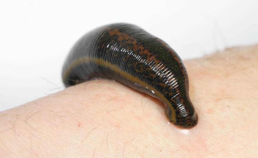 What We Can Learn From The Genome Of Doctors' Favorite Medicinal Leech