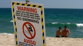Signs warn the public to stay out of the water in an area harboring high bacteria levels near a drain at Will Rogers State Beach on August 7, 2007 in Pacific Palisades, northwest of Los Angeles, California.