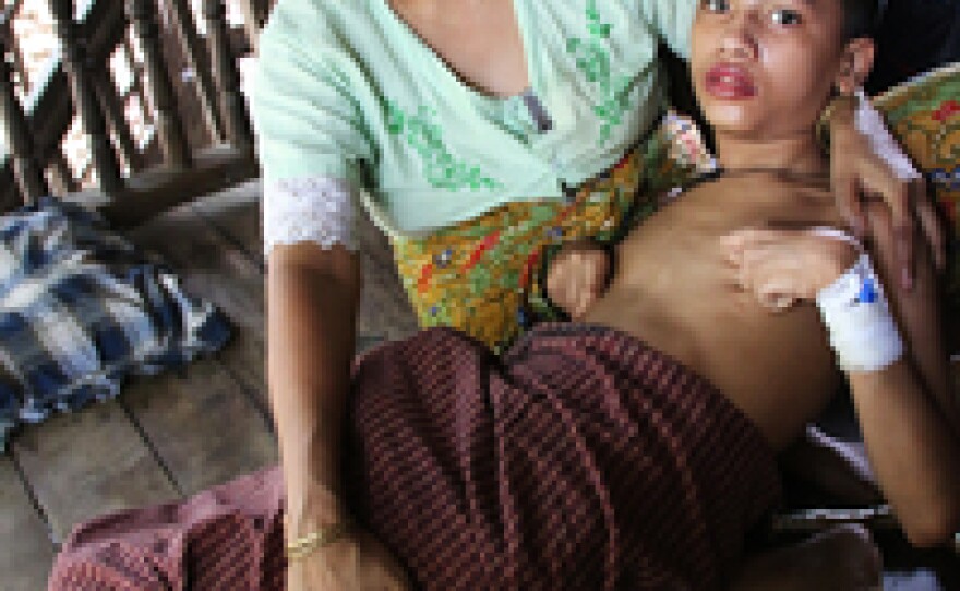 Zomir Hussein, 13, suffered mental damage from an accidental overdose of tuberculosis medicine. He is unable to go into Sittwe to the only hospital that can treat him because he is a Rohingya, most of whom are now confined to camps for internally displaced persons, where there are few doctors.