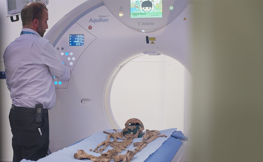 Alan Rout by CT Scanner