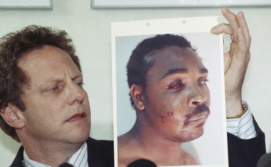 In 1991, Steven Lerman, an attorney for Rodney King, displays a photo of his client during a press conference in Beverly Hills. King was beaten by Los Angeles police officers who were later acquitted, sparking riots across the city.