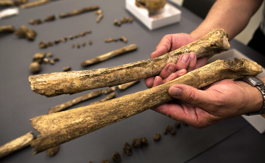 Owsley holds thigh bones from two different skeletons. The one above has a ridge that suggests the man may have had muscular legs — perhaps from riding horseback.