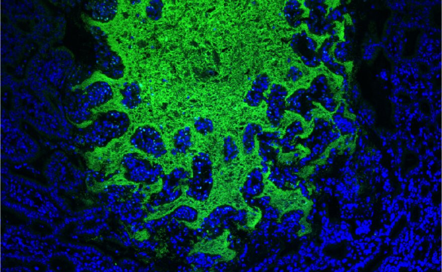 Visualization of a bacteria by fluorescence in the small intestine of mice. 