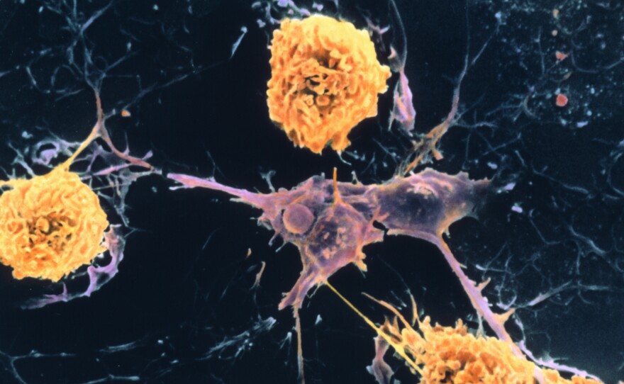 A scanning electron micrograph shows microglial cells (yellow) ingesting branched oligodendrocyte cells (purple), a process thought to occur in multiple sclerosis. Oligodendrocytes form insulating myelin sheaths around nerve axons in the central nervous system.