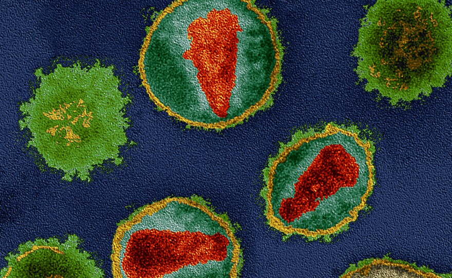 HIV is like a jack-in-the-box: When it binds to a cell, its shell (yellow) pops open, and its genetic material (reds) comes out.