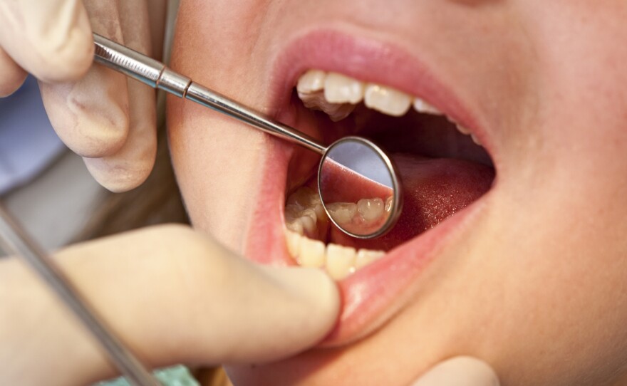 Dental care for adults was cut from Medi-Cal during the recession.