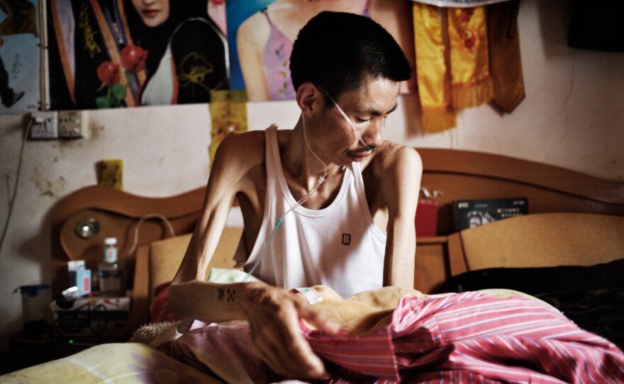 A shadow of himself. Former gold miner He Quangui, who has incurable silicosis from years of blasting rock in illegal mines, once weighed 65kg and is now a skeletal 44kg. He looks at himself moments after peeling himself up from bed one morning.