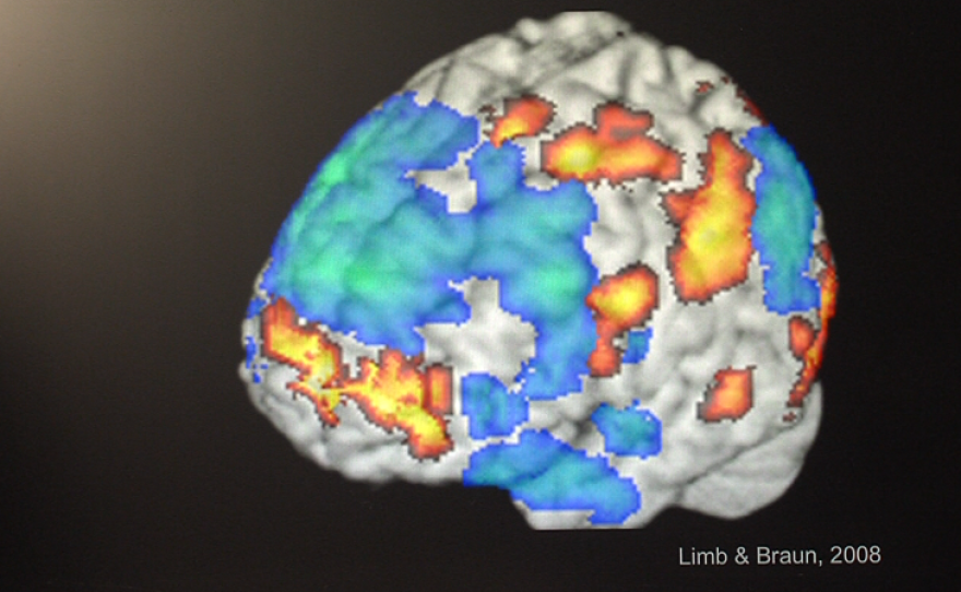 An illustration shows a musician's brain activity during improvisation. The blue areas show a suppression of activity in the parts of the brain that control the inner dialogue.