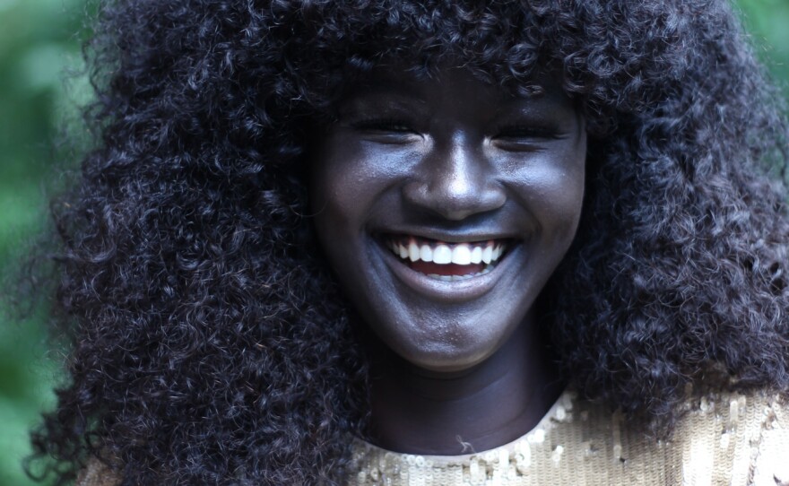 Diop was told by cousins to lighten her skin with beauty products, but her sister told her not to because her skin was beautiful.